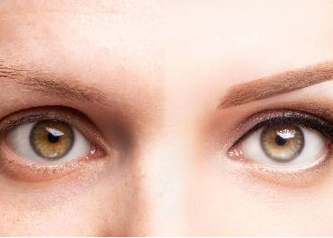 Ламиниране