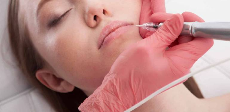 Плазма пен процедура