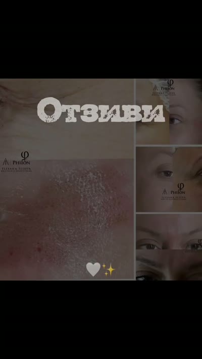 Плазма пен — отзиви от различни процедури