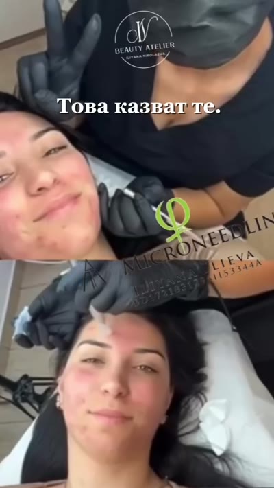 Отзиви от различни процедури — ревюта от Google