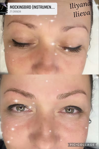 Микроблейдинг — преди и след